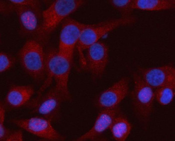 Anti-RASSF8 / Ras association domain-containing protein 8