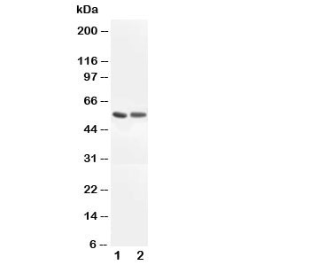 Anti-ALDH1A1