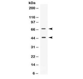 Anti-CD33
