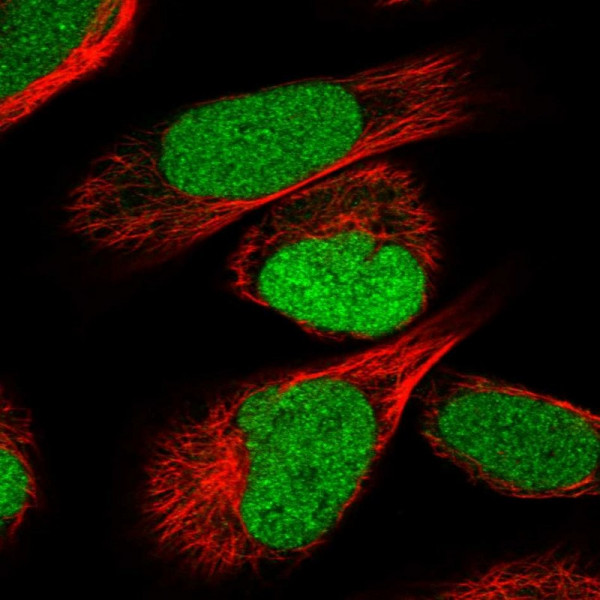 Anti-IRF2BP2