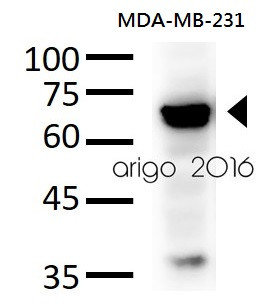 Anti-c-Fos, clone 7D6-A9-D4