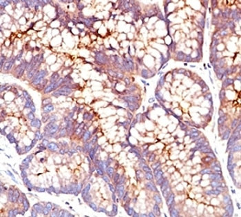 Anti-CEA / Carcinoembryonic Antigen, clone SPM541