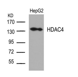 Anti-HDAC4 (Ab-632)