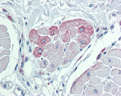Anti-TRPM2