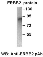 Anti-ERBB2 polyclonal