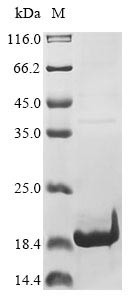 Non-structural protein 4 (4), human coronavirus HKU1, recombinant