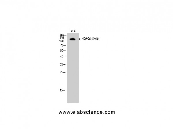 Anti-Phospho-HDAC5 (Ser498)