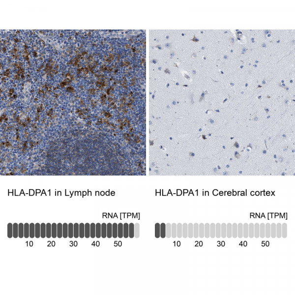 Anti-HLA-DPA1
