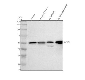 Anti-SMYD1 / SET and MYND domain-containing protein 1