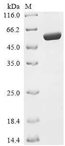 Amidophosphoribosyltransferase (purF), Mycobacterium tuberculosis, recombinant