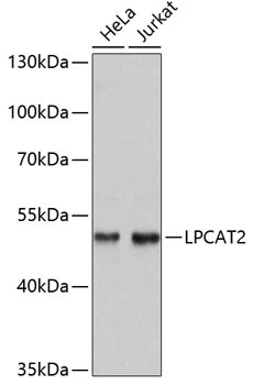 Anti-LPCAT2