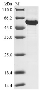 Nuclear receptor ROR-alpha (RORA), human, recombinant