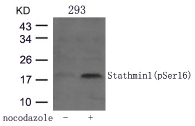 Anti-phospho-Stathmin 1 (Ser16)