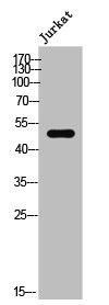 Anti-Phospho-DPYSL2 (T509)