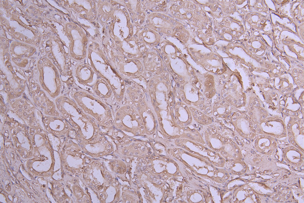 Anti-IL1B, recombinant clone 6E4