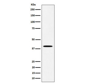 Anti-DLX3 / Homeobox protein DLX-3, clone 29D60