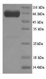 Pyruvate kinase PKLR (PKLR), human, recombinant