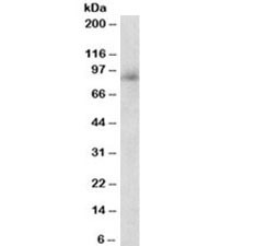 Anti-Myeloperoxidase