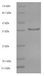 TATA box-binding protein-like protein 1 (TBPL1), partial, human, recombinant