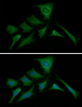 Anti-PKM2, clone 1B10