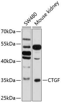 Anti-CTGF
