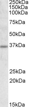 Anti-Uncoupling protein 2 / UCP2, Internal