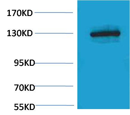 Anti-E-Cadherin