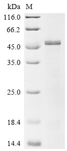 RING finger protein 126 (RNF126), human, recombinant