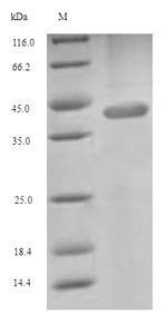 Excitatory amino acid transporter 4 (SLC1A6), partial, human, recombinant