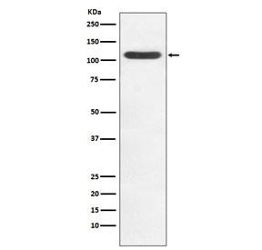 Anti-HIP1 / Huntingtin-interacting protein 1, clone AFG-8