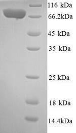 Interleukin-12 receptor subunit beta-2 (IL12RB2), partial, human, recombinant