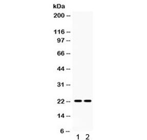 Anti-Lipocalin 2 / NGAL / LCN2
