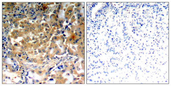 Anti-phospho-PKC Zeta (Thr410)