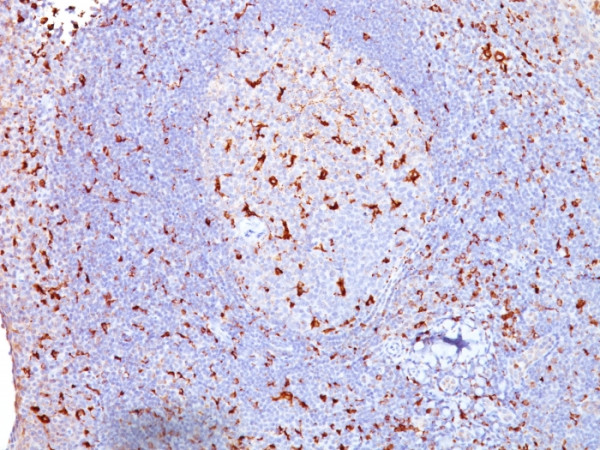 Anti-CD68 (Macrophage Marker), clone SPM130