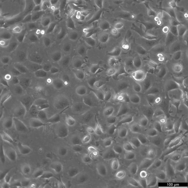 KYSE-410 Cells