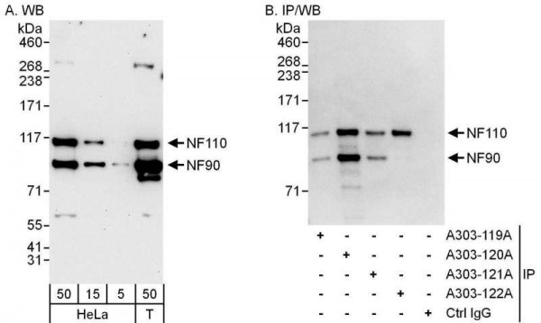 Anti-NF90/NF110