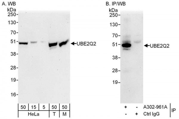 Anti-UBE2Q2