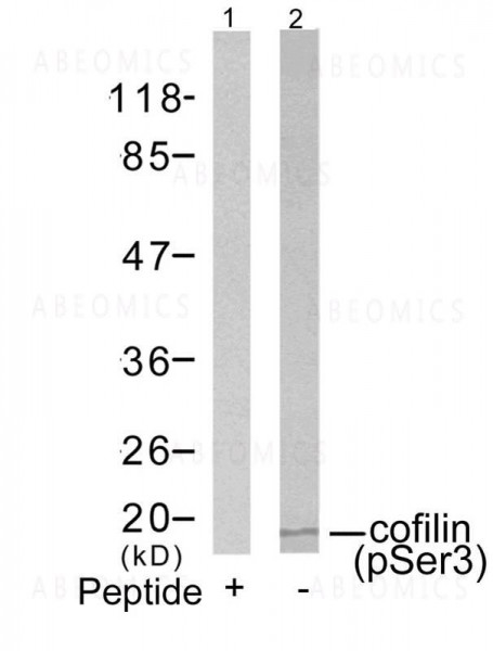 Anti-phospho-cofilin (Ser3)