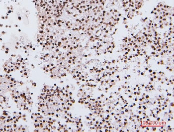 Anti-NRF1 / Nuclear Respiratory Factor 1, clone 2G4
