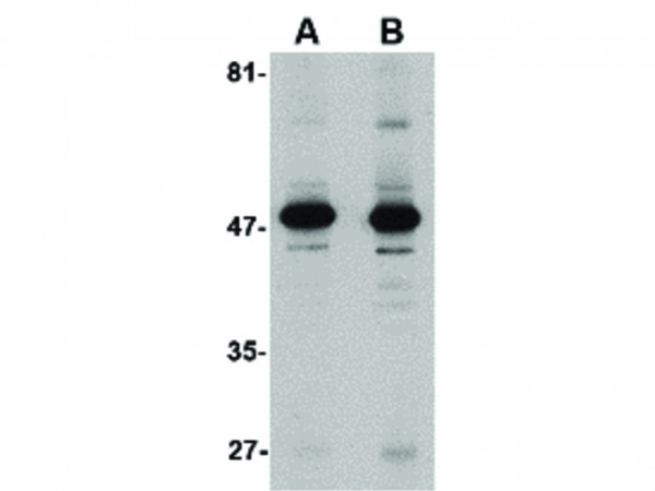 Anti-Aldh3A1