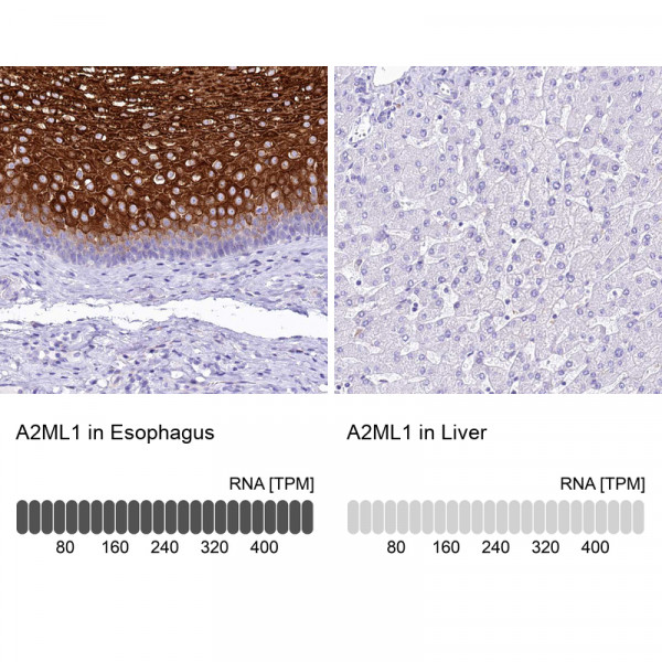 Anti-A2ML1