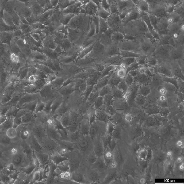 Hs 578T Cells