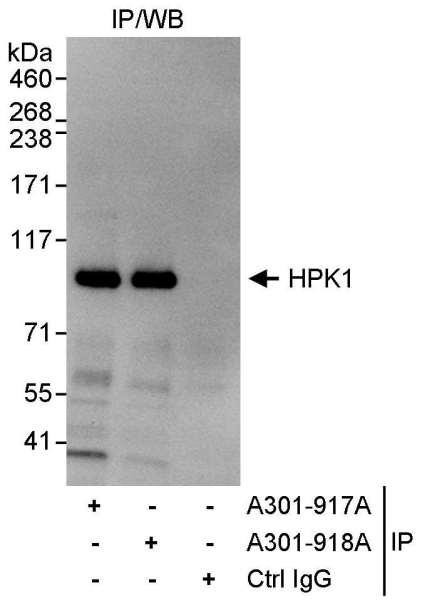 Anti-HPK1