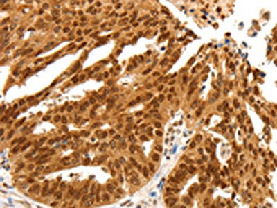 Anti-PDCD6