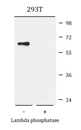 Anti-phospho-AMPK alpha 2 (Ser491)