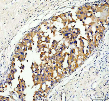 Anti-Serine racemase / SRR