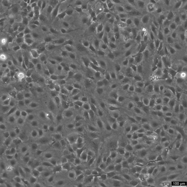 HMEC-1 Cells