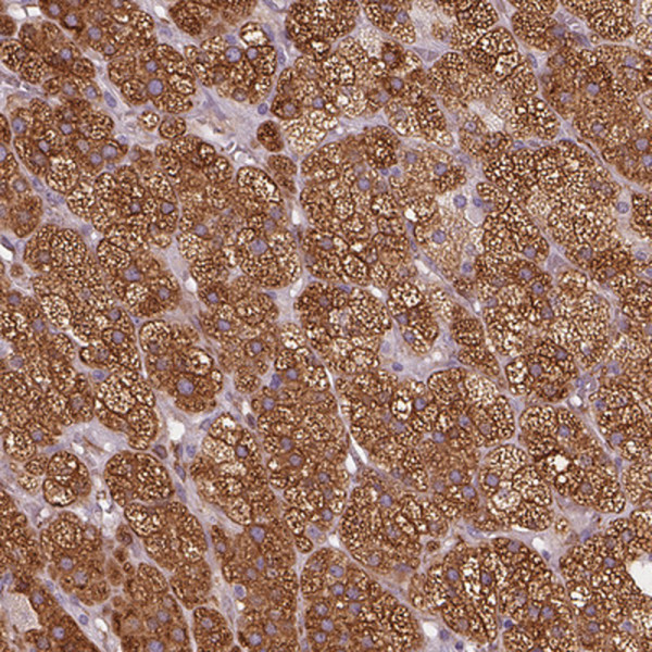 Anti-HSD3B1