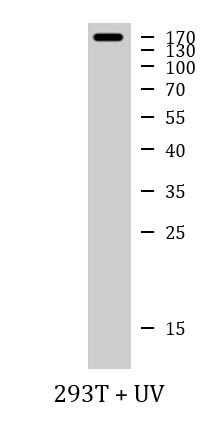 Anti-phospho-CD135 / Flt3 (Tyr842)