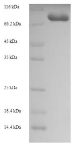 Glycerol kinase 2 (GK2), partial, human, recombinant